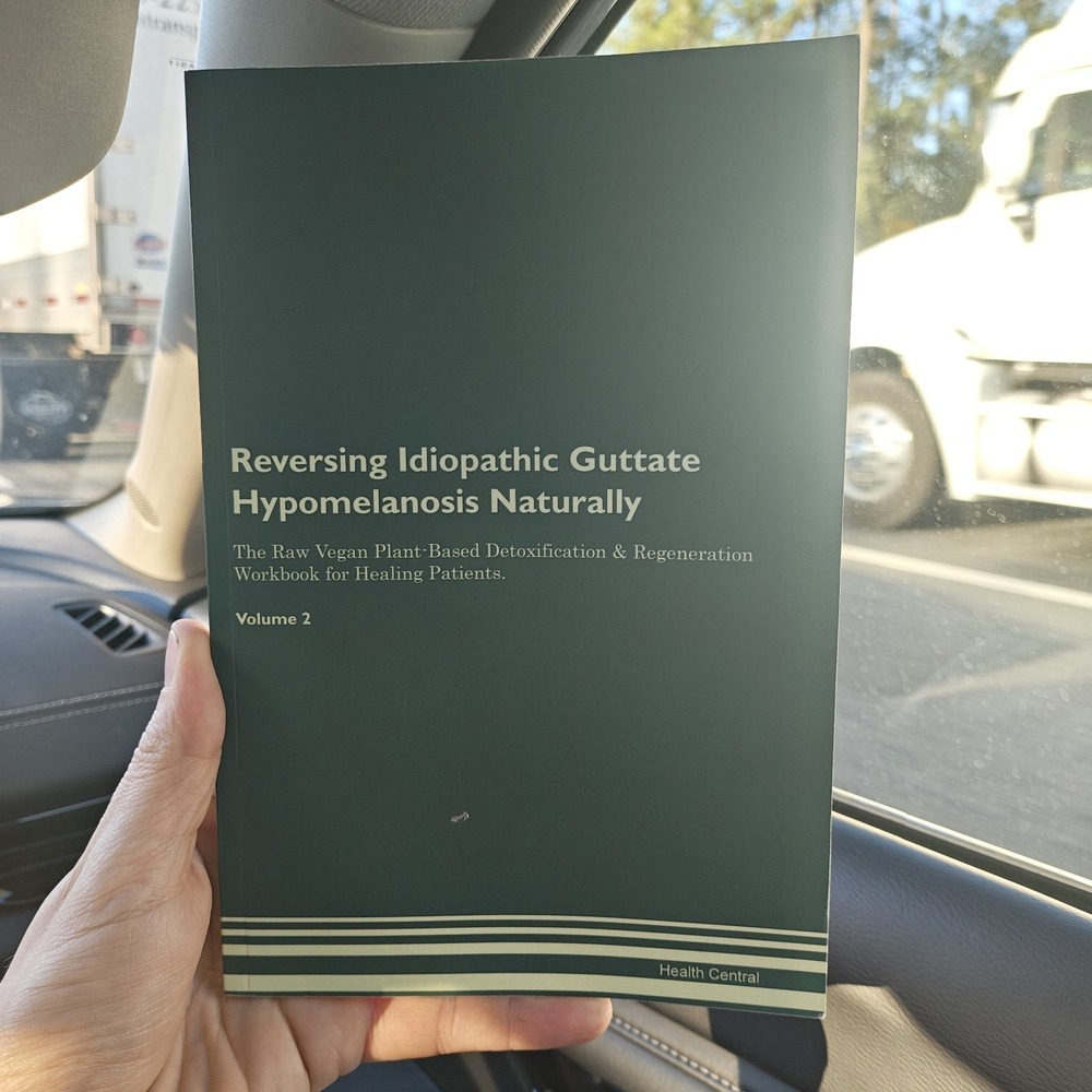 Reversing Idiopathic Guttate Hypomelanosis Naturally Volume 2 9781395247829